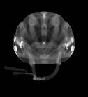 Велосипедний шолом, рентген, радіологічне сканування — стокове фото