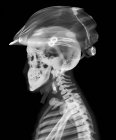 Crâne et casque, radiographie. — Photo de stock