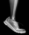 Нижняя нога скелета в резиновой обуви ходьба, рентген. — стоковое фото