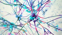 Антитела атакуют нейроны. Концептуальная компьютерная иллюстрация аутоиммунных неврологических заболеваний — стоковое фото