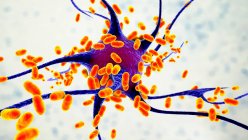 Encefalite bacteriana. Ilustração conceitual do computador mostrando bactérias infectando células cerebrais — Fotografia de Stock