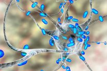 Encefalitis bacteriana. Ilustración conceptual por ordenador que muestra bacterias infectando las células cerebrales - foto de stock
