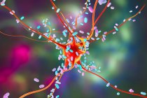 Бактеріальний енцефаліт. Концептуальна комп'ютерна ілюстрація, що показує бактерії, що заражають клітини мозку — стокове фото