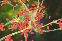 Encéphalite bactérienne. Illustration conceptuelle par ordinateur montrant des bactéries infectant les cellules cérébrales — Photo de stock