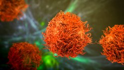 Célula de cáncer de estómago, ilustración por computadora - foto de stock