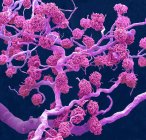 Glomérulos renais. Micrografia eletrônica de varredura colorida (MEV) de um molde de resina de capilares de glomérulos e os vasos sanguíneos maiores que lhes fornecem sangue — Fotografia de Stock