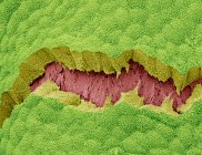 Vessie biliaire. Micrographie électronique à balayage coloré (MEB) de la surface d'une vésicule biliaire. Cette muqueuse est constituée de cellules épithéliales cuboïdes (vert) — Photo de stock