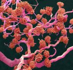 Glomeruli renali. Micrografo elettronico a scansione colorata (SEM) di un getto di resina di glomeruli capillari e dei vasi sanguigni più grandi che forniscono loro sangue — Foto stock