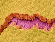 Vejiga biliar. Micrografía electrónica de barrido de color (SEM) de la superficie de una vesícula biliar. Este revestimiento de la mucosa se compone de células epiteliales cuboidales (amarillo) - foto de stock