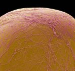 Жировая клетка. Цветной сканирующий электронный микрограф (СЭМ) части жиронакопительной клетки (адипоцитов). Жировые клетки являются одним из крупнейших типов клеток в организме человека, каждая клетка составляет от 100 до 120 микрон в диаметре — стоковое фото