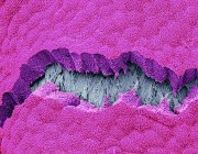 Vejiga biliar. Micrografía electrónica de barrido de color (SEM) de la superficie de una vesícula biliar. Este revestimiento de la mucosa se compone de células epiteliales cuboidales (rosa) - foto de stock