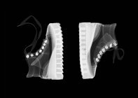 Wedge ankle boots, X-ray. — Stock Photo