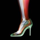 Menschliches Bein und Stilettoschuh, Röntgenbild. — Stockfoto