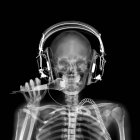 Disco jockey, rayos X, escáner radiológico - foto de stock