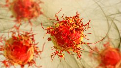 Ракові клітини шкіри, комп'ютерна ілюстрація . — стокове фото