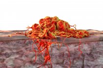 Вторгнення раку в навколишні тканини, концептуальна комп'ютерна ілюстрація . — стокове фото