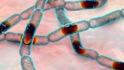Бактерії Anthrax, комп'ютерна ілюстрація. Бактерії антракса (Bacillus anthracis) є причиною хвороб у людей і худоби. — стокове фото