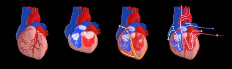 Herz-Kreislauf-System und elektrisches System des Menschen, 3D-Illustration. Querschnitt des Herzens mit den Herzkammern und Herzklappen sowie dem elektrischen (Leitungs-) System (gelbe Linien) und dem Kreislauf (rote und blaue Linien)). — Stockfoto