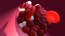 Blood clot, computer illustration — Stock Photo