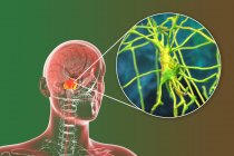 Людський мозок з виділеними картками та нейронами, ілюстрації. Людський мозок з виділеними картками Варолі та вид пірамідальних нейронів (нервових клітин), розташованих у кістках. — стокове фото