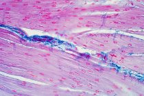 Muscolatura liscia umana, micrografo leggero. — Foto stock