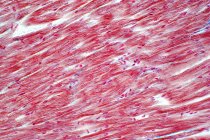 Human cardiac muscle, light micrograph. — Stock Photo