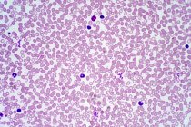 Cellule umane del sangue, micrografo leggero. — Foto stock