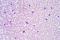 Людські кров'яні клітини, легкий мікрограф.. — стокове фото