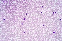 Людські кров'яні клітини, легкий мікрограф.. — стокове фото