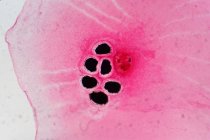 Micrografía ligera de huevos de trepa hepática en una escama de pescado. - foto de stock