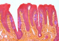 Goût bourgeons. Micrographie lumineuse colorée d'une section à travers la langue, montrant les papilles gustatives (rondes, violettes). Les papilles (saillies) situées à la surface de la langue contiennent les papilles gustatives. — Photo de stock