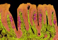 Смак бутонів. Кольоровий світловий мікрограф ділянки через язик, що показує смакові рецептори (круглий, фіолетовий). Смакові бутони знаходяться всередині папіломи (проекції), розташованої на поверхні язика — стокове фото