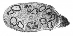 Nervio periférico. Micrografía electrónica de transmisión en blanco y negro (TEM) de una sección a través de un pequeño nervio periférico. La mielina (anillos oscuros) es una capa grasa aislante que rodea las fibras nerviosas mielinizadas. - foto de stock