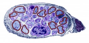 Nervio periférico. Micrografía electrónica de transmisión coloreada (TEM) de una sección a través de un pequeño nervio periférico. La mielina (marrón) es una capa grasa aislante que rodea las fibras nerviosas mielinizadas (azul).) - foto de stock