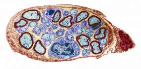 Nervo periférico. Micrografia eletrônica de transmissão colorida (MET) de uma seção através de um pequeno nervo periférico. A mielina (marrom) é uma camada gordurosa isolante que envolve as fibras nervosas mielinizadas (ciano).) — Fotografia de Stock
