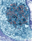 Particules du virus de la tumeur mammaire de la souris (MMTV) (bleu), micrographie électronique à transmission colorée (TEM). MMTV induit des tumeurs malignes dans les glandes mammaires de certaines souches de souris de laboratoire — Photo de stock