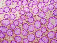 Crypts of Lieberkuhn. Light micrograph (LM). Crypts of Lieberkuhn of the colon shown in cross section. Crypts are long blind-ending tube-like extensions of the surface epithelial lining of the gut — Stock Photo