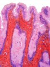 Epitelio superficial del estómago, micrografía ligera (LM). El epitelio superficial del estómago es un epitelio columnar simple formado por células mucosas altas que invaginan para formar los pozos gástricos. - foto de stock