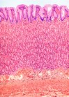 Doublure de l'estomac. Micrographie lumineuse colorée (LM) de l'estomac. La lumière est en haut (blanc). La surface de la muqueuse se compose de cellules cylindriques simples qui sécrètent du mucus — Photo de stock
