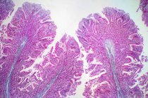 Tessuto intestinale crasso umano, micrografo leggero. — Foto stock