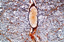 Sección transversal de la médula espinal, micrografía ligera. - foto de stock