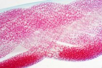 Uova di ascaridi (Toxocara canis), micrografo leggero. — Foto stock
