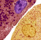 Cellule pancreatiche. Micrografo elettronico a trasmissione colorata (TEM) di cellule pancreatiche acinari (esocrine) (rosse) adiacenti all'isolotto ormonale (endocrino) secernente le cellule di Langerhans (giallo) — Foto stock