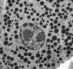 Тканина панкреатиту. Трансмісійний електронний мікрограф (ТЕМ) частини екзокринної підшлункової залози. Тут видно цимогенні гранули та клітинні ядра. На зображенні чітко видно ендоплазматичний ретикулум, який заповнює цитоплазму . — стокове фото