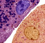 Підшлункові клітини. Кольоровий електронний мікрограф (ТЕМ) ацинарних (екзокринних) підшлункових клітин (червоних) суміжних з гормоносекретуючими (ендокринними) клітинами острова Лангеранс (жовті)) — стокове фото