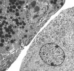 Células pancreáticas. Micrografía electrónica de transmisión coloreada (TEM) de células pancreáticas acinares (exocrinas) (rojas) adyacentes a células secretoras de hormonas (endocrinas) Islote de células de Langerhans (amarillas) - foto de stock