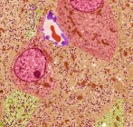 Pancreatic islet cells. Colored transmission electron micrograph (TEM) of a section through pancreas tissue, showing cells known as Islets of Langerhans. These cells occur in distinct ovoid clusters numbering about 1 million in humans — Stock Photo