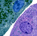 Поджелудочная железа. Цветной трансмиссионный электронный микрограф (ТЭМ) ацинарных (экзокринных) клеток поджелудочной железы (красных), прилегающих к гормонально-секретирующим (эндокринным) островкам клеток Лангерганса (желтых)) — стоковое фото