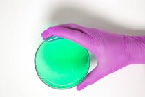Mano che tiene una capsula di Petri con mezzo di crescita verde. — Foto stock