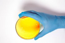 Hand holding a petri dish with yellow agar. — Stock Photo